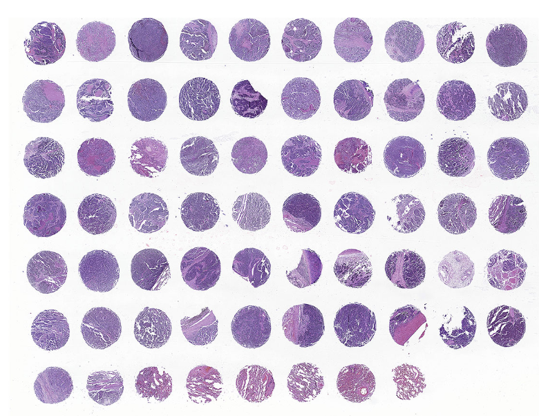 tissue microarray-RLN681
