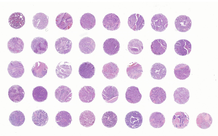 tissue microarray-RLN401b